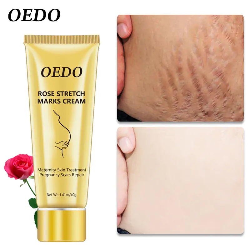 OEDO Stretch Mark Cream