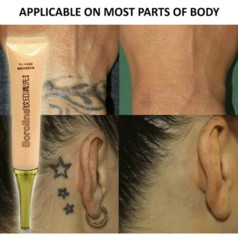 Permanent Tattoo Cream Removal